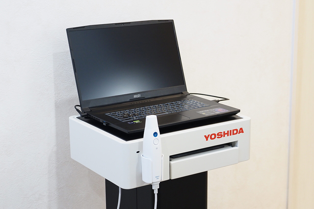 口腔内スキャナー