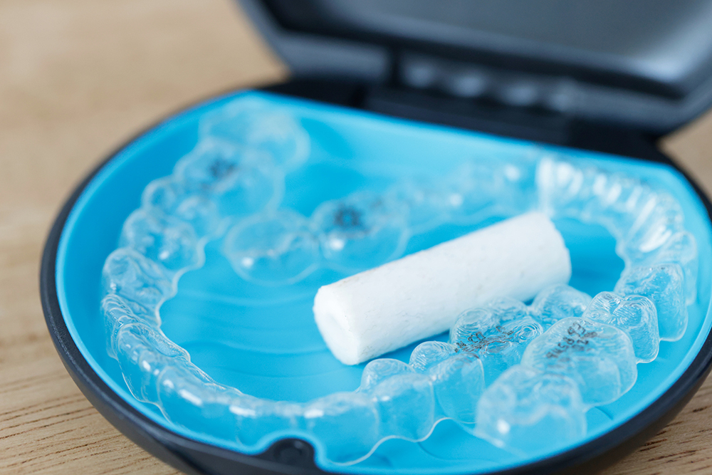 インビザライン