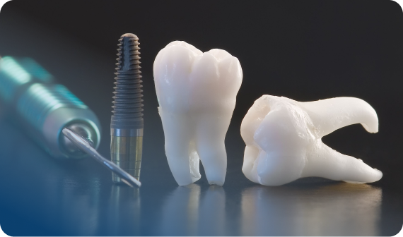 インプラント治療