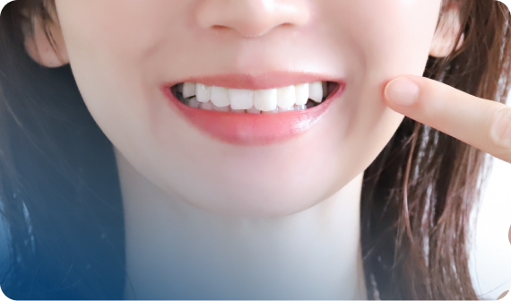 ホワイトニング