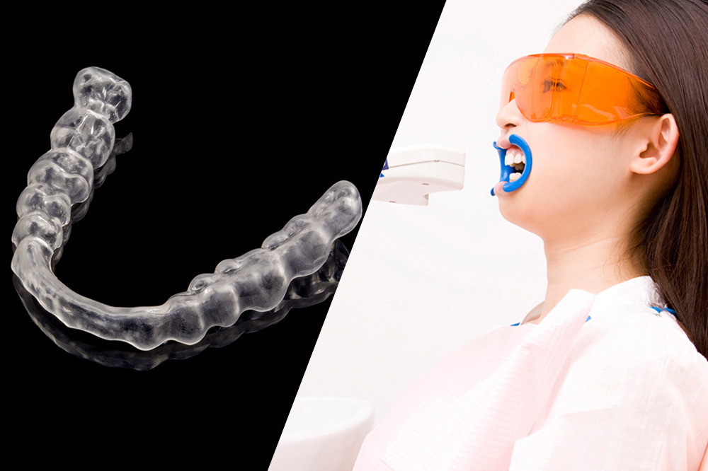 デュアルホワイトニング